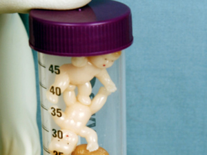 好孕案例